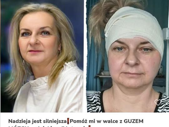 BIAŁA PODLASKA: Pomóżmy Justynie w walce z nowotworem mózgu