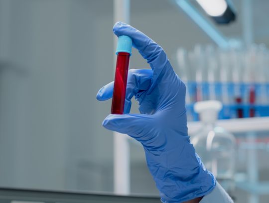 Brakuje krwi. Krwiobusy odwiedzą m.in. Janów Podlaski i Radzyń Podlaski