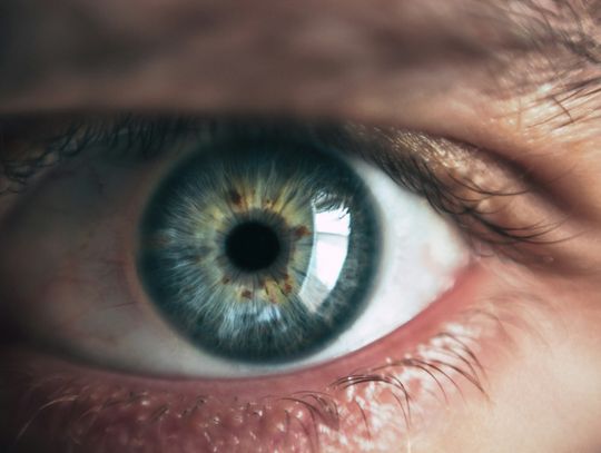 Krople do oczu — jakie wybrać, dlaczego i jak aplikować?