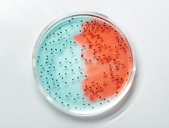 Mykoplazma – objawy zakażenia i drogi przenoszenia Mykoplazma – objawy zakażenia i drogi przenoszenia