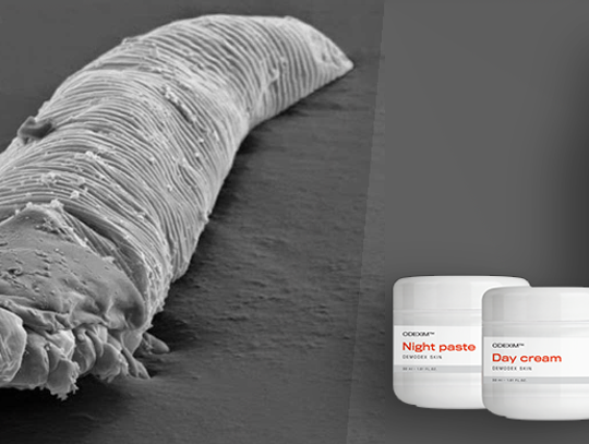 Nużeniec ludzki – czy można go zwalczyć?