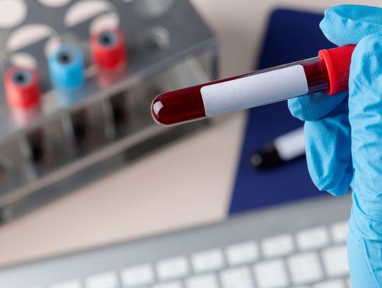 Oddaj krew – pomóż Oliwce z Konstantynowa