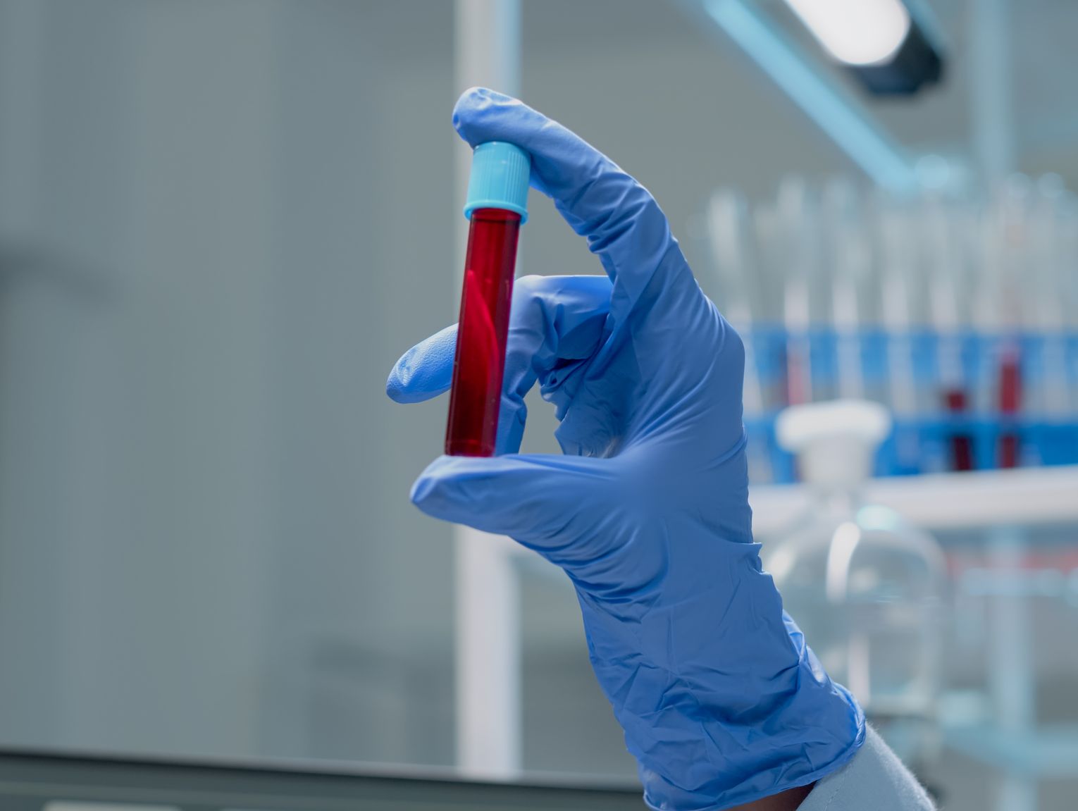 Brakuje krwi. Krwiobusy odwiedzą m.in. Janów Podlaski i Radzyń Podlaski