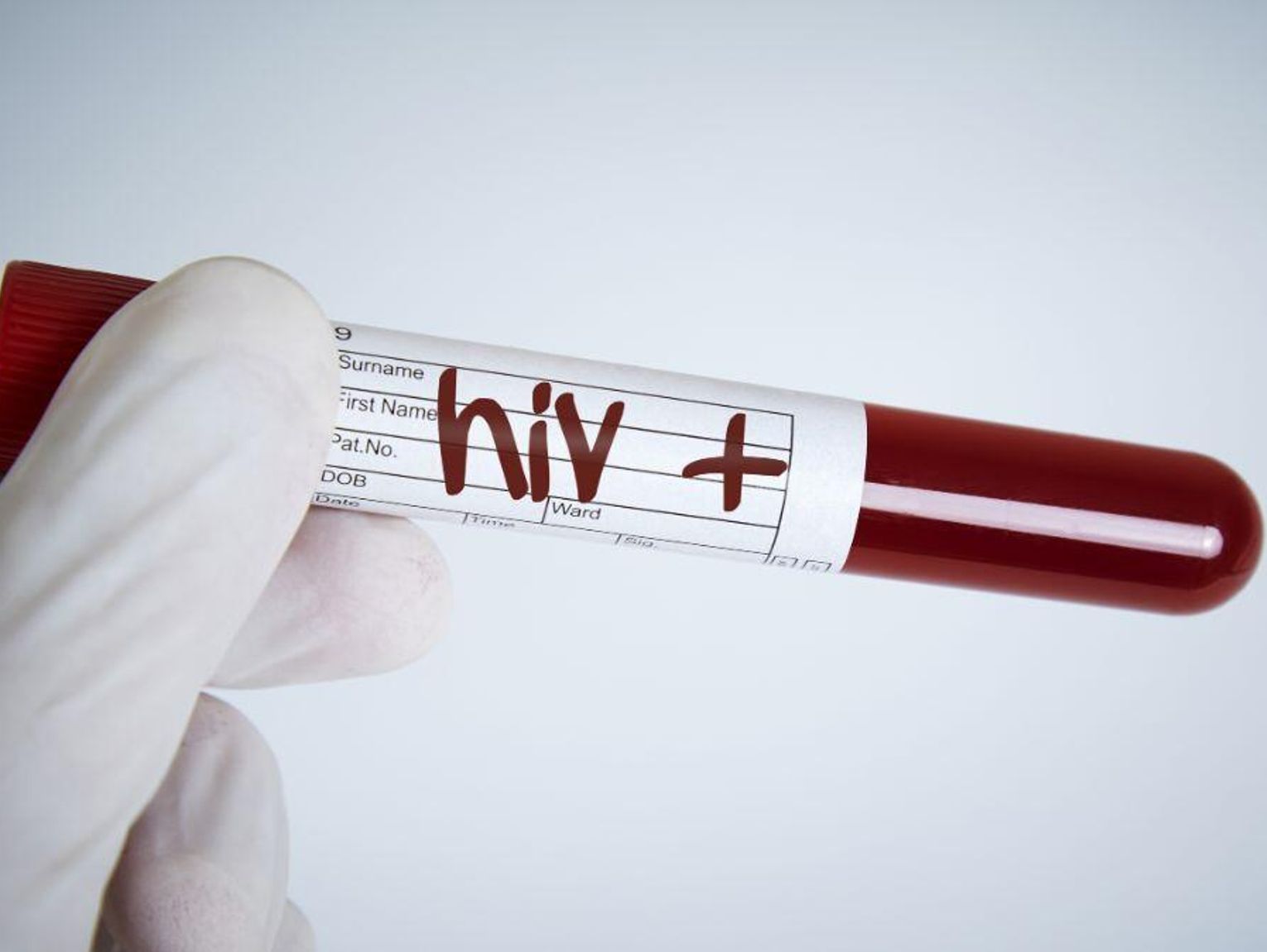 Coraz więcej przypadków HIV w Polsce. W większości nie wiadomo, jak doszło do zakażenia