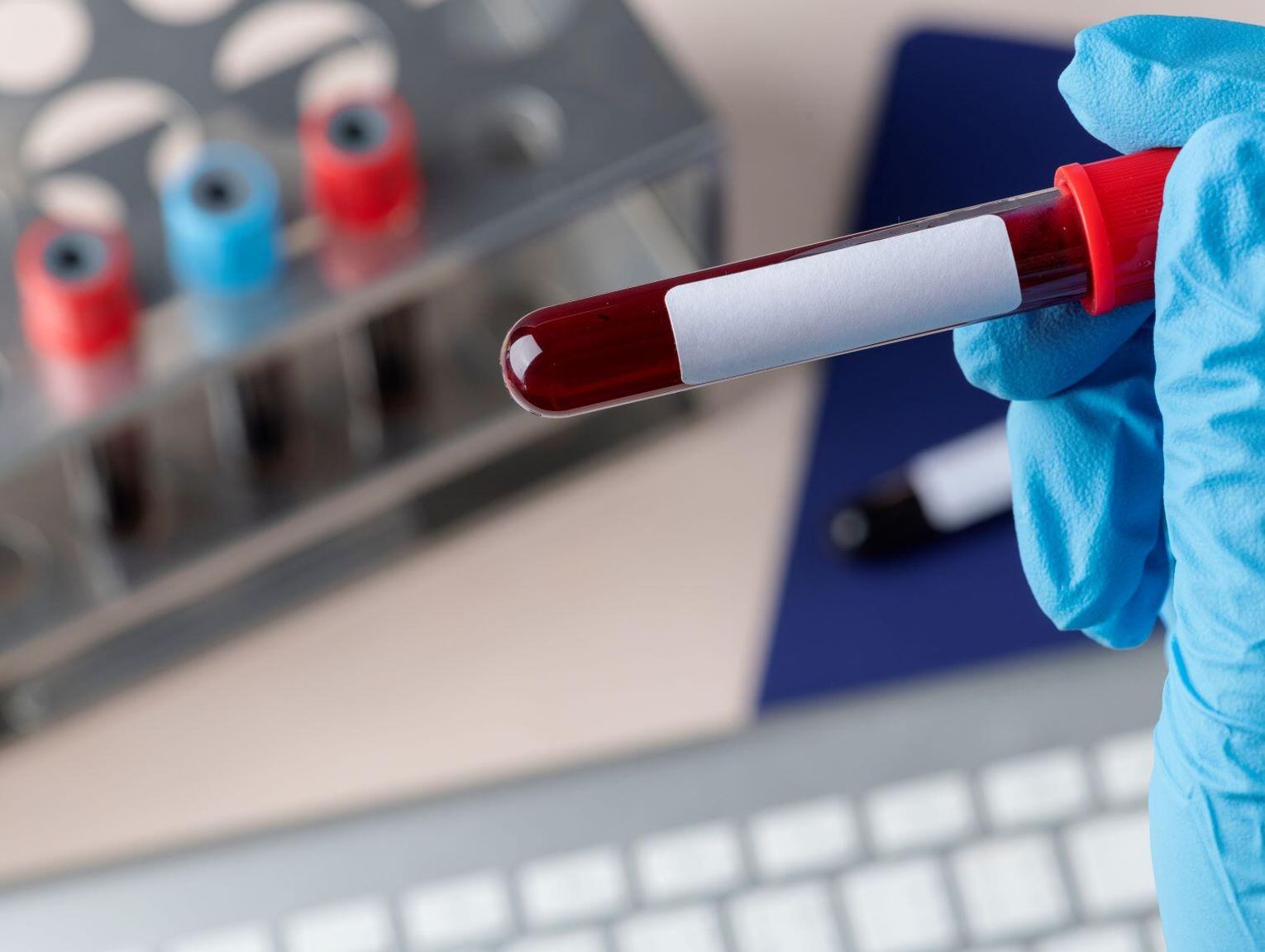 Oddaj krew – pomóż Oliwce z Konstantynowa