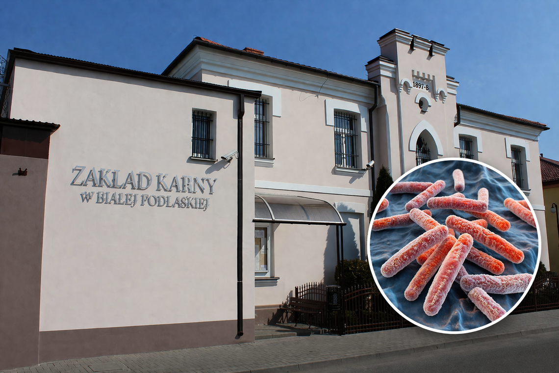gruźlica w zakładzie karnym w białej podlaskiej biała podlaska więzienie choroba pracował w kuchni