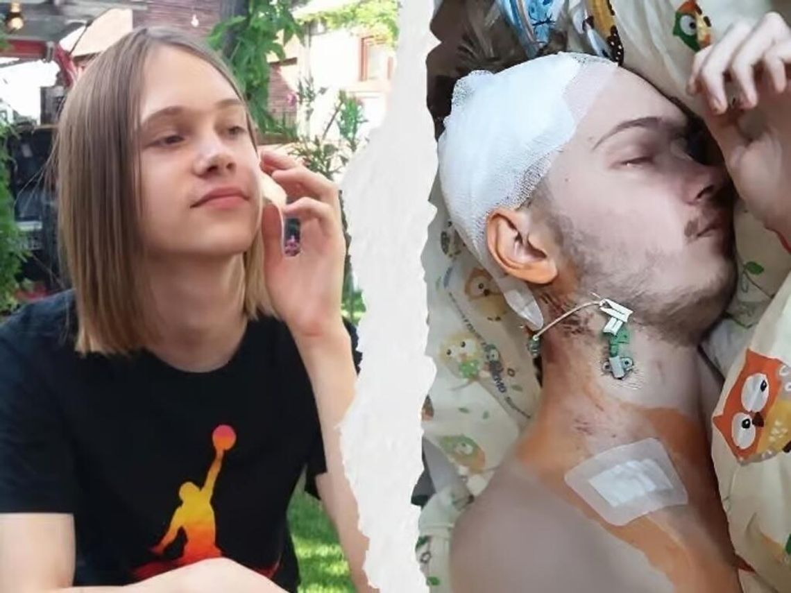 Biała Podlaska. Igor ma 20 lat i cierpi na glejaka mózgu. Trwa zbiórka na leczenie Biała Podlaska. Igor ma 20 lat i cierpi na glejaka mózgu. Trwa zbiórka na leczenie