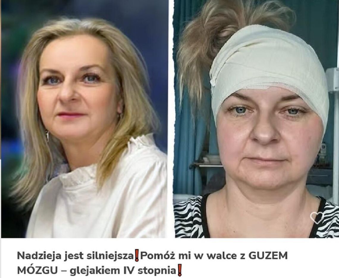 BIAŁA PODLASKA: Pomóżmy Justynie w walce z nowotworem mózgu