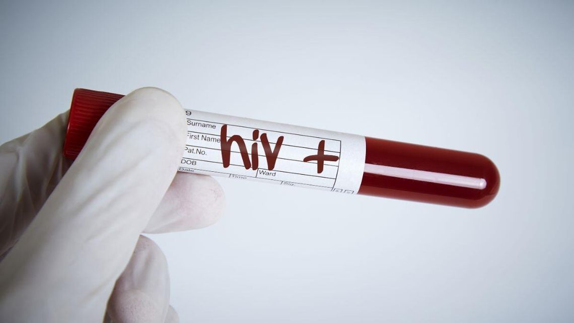 Coraz więcej przypadków HIV w Polsce. W większości nie wiadomo, jak doszło do zakażenia Coraz więcej przypadków HIV w Polsce. W większości nie wiadomo, jak doszło do zakażenia