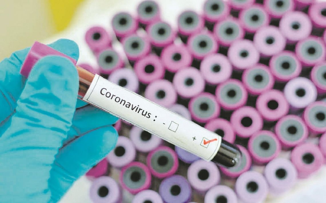 Koronawirus: W bialskim szpitalu zmarły dwie osoby zakażone Covid-19