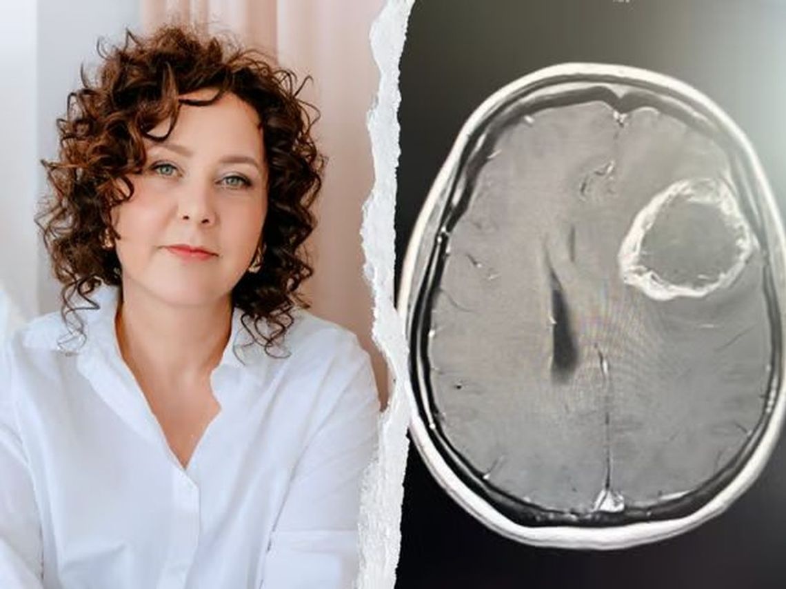 „Nie chcę być dla moich dzieci tylko wspomnieniem”. Pomóżmy Annie wrócić do zdrowia „Nie chcę być dla moich dzieci tylko wspomnieniem”. Pomóżmy Annie wrócić do zdrowia