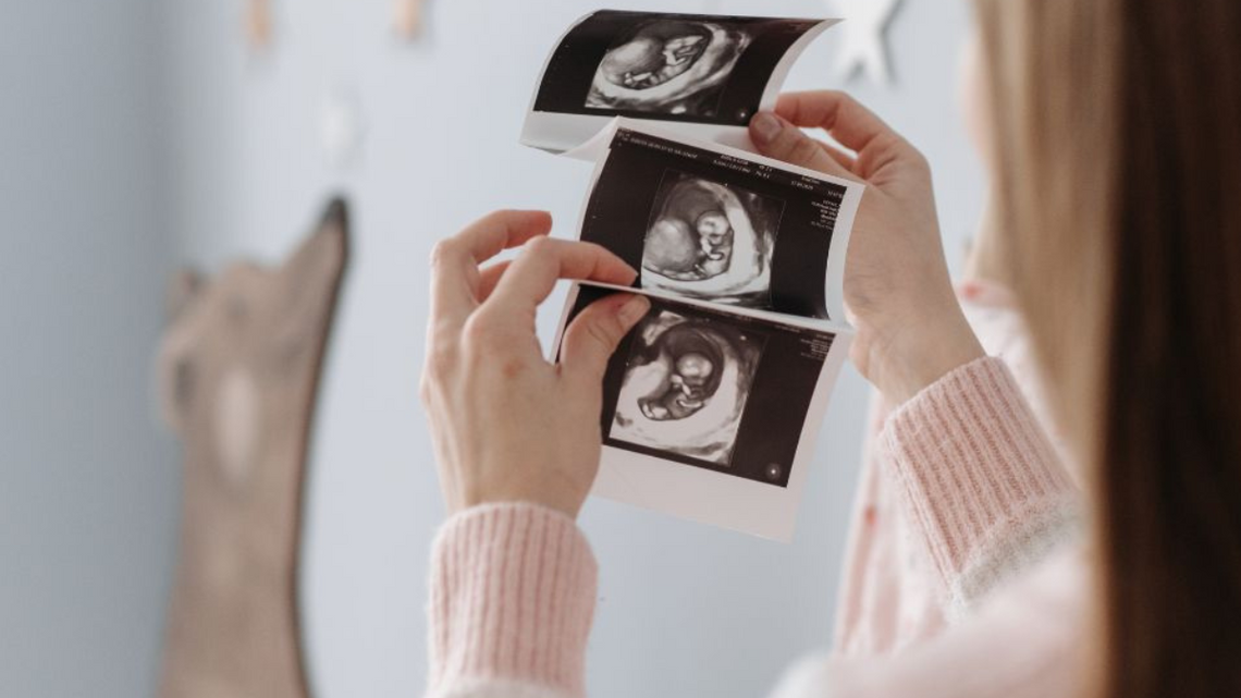 Od teraz badanie prenatalne są dla każdej ciężarnej. Bez żadnych warunków